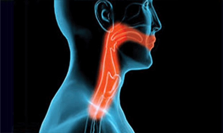 x-ray image of the throat area